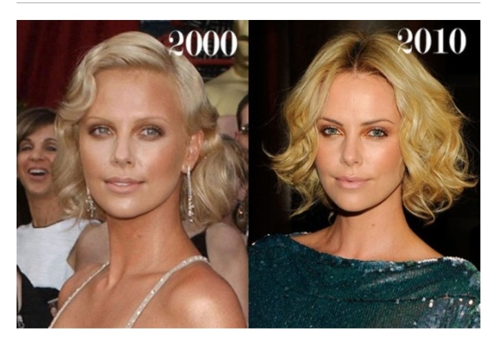 Charlize Theron Botox