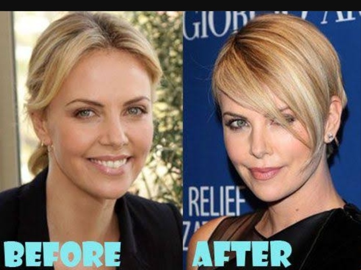 Charlize Theron Botox