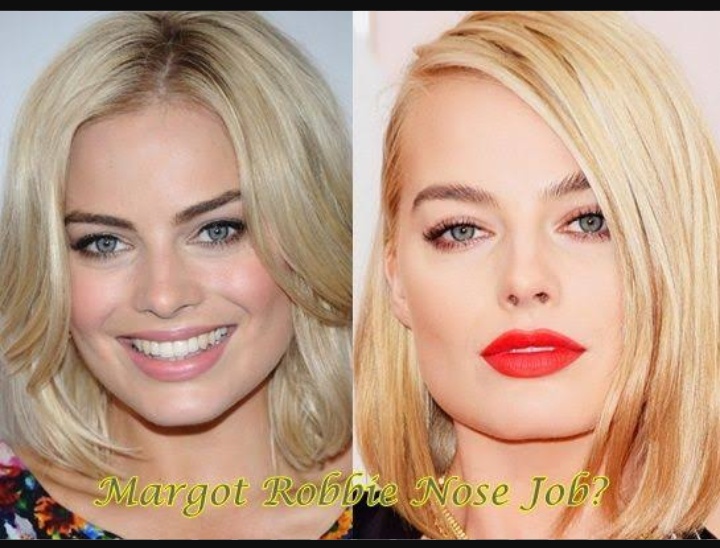 Margot Robbie's Plastic Surgery (Nose Job), Age, Wiki, Bio, Wiki & More