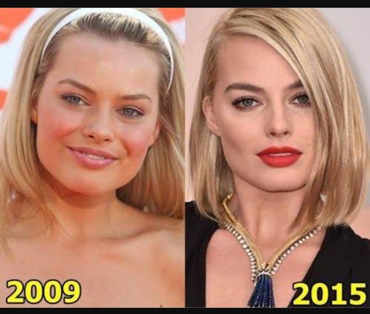 Margot Robbie's Plastic Surgery