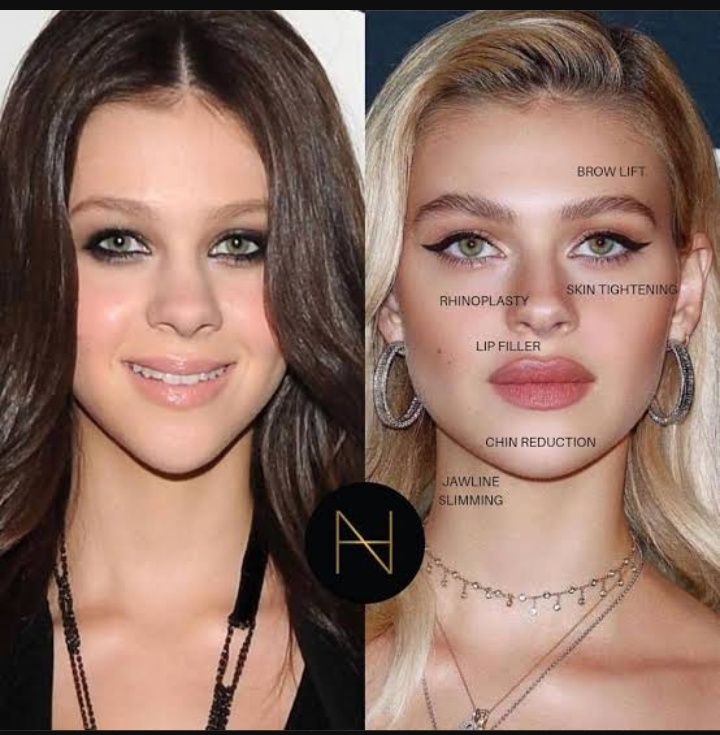 Nicola Peltz's Plastic Surgery