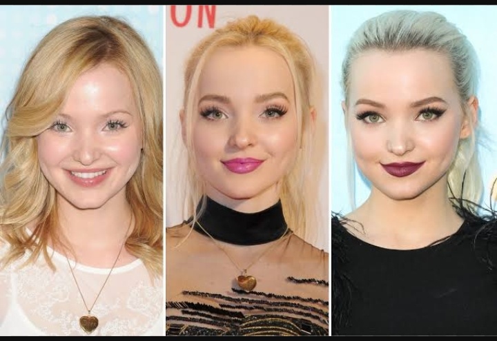 Dove Cameron Before Plastic Surgery